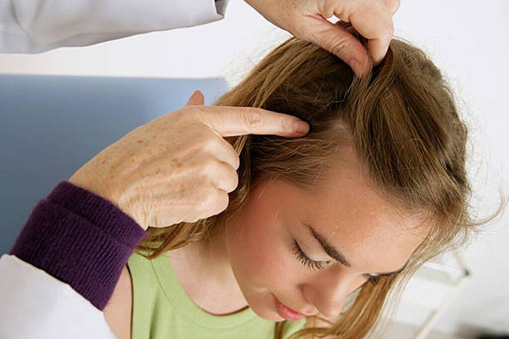 What Causes Dandruff