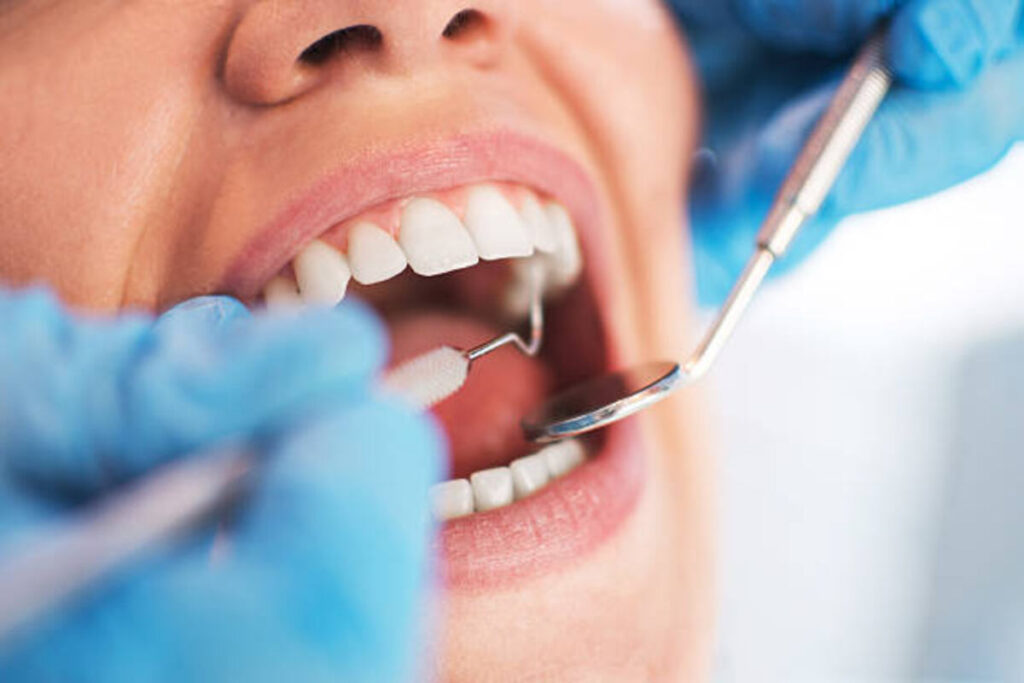 Deciding on the best Dental Treatment for You