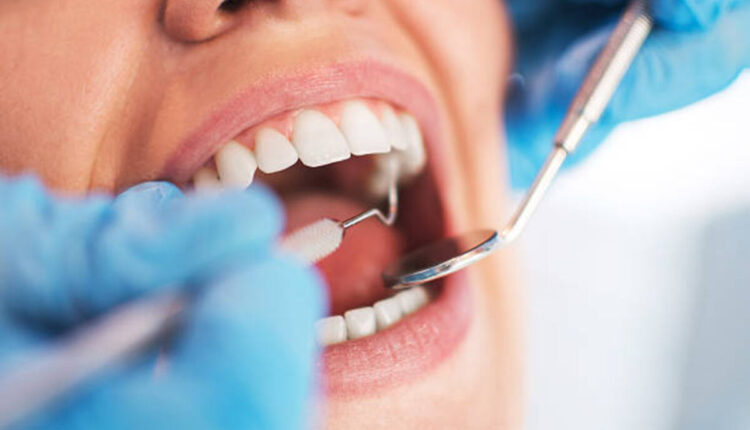 Deciding on the best Dental Treatment for You